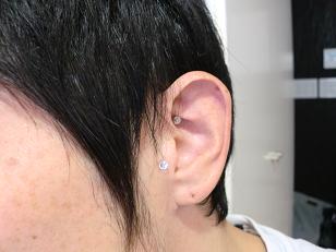 耳ツボ!_f0172281_6363369.jpg