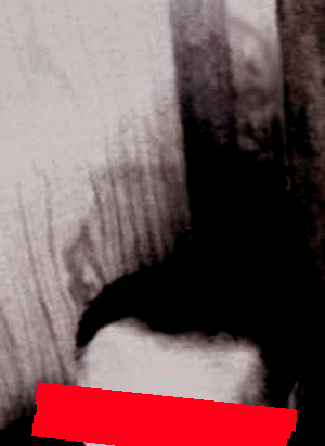 e0103408_1720252.gif