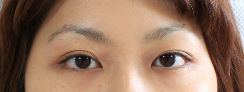 アートメイク　フルセット　初回_c0124015_1264922.jpg