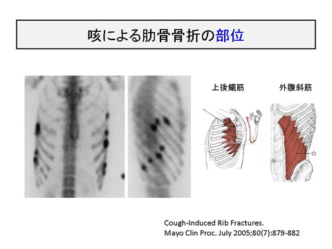 よく見られる症状 咳 その1 井蛙内科開業医 診療録 ４