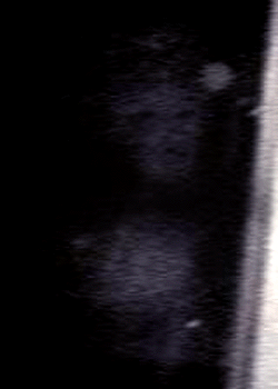 e0103408_1575981.gif