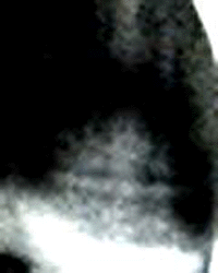 e0103408_173714.gif