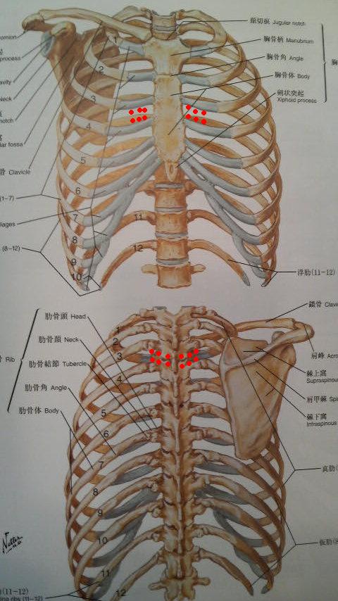 チャップマン反射を利用したセルフトリートメント　Vol. ８_d0174624_10374915.jpg