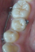 f0063659_6515781.jpg