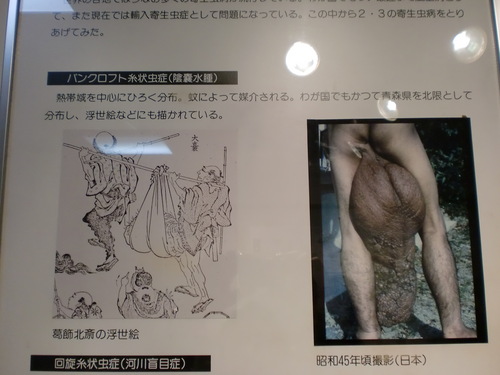 の 水腫 大人 う いん