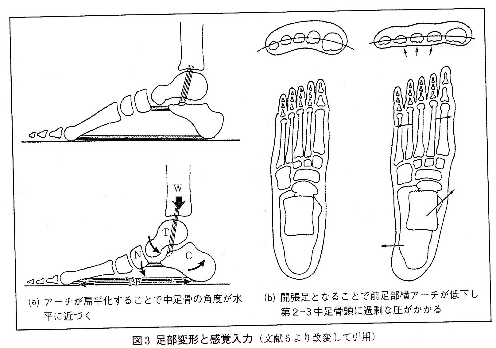 足にあった靴の選択について 理論編 がんばらねばいかんぜよ