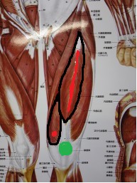 身体の痛み~知られていない筋肉が原因の痛み~_f0214534_14135351.jpg