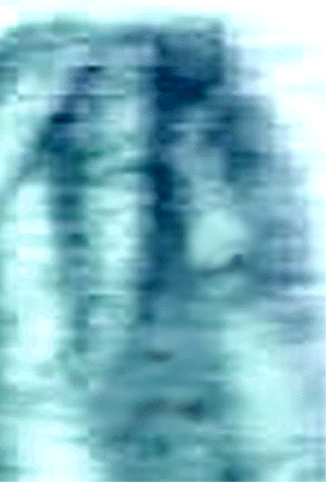 e0103408_18284357.gif