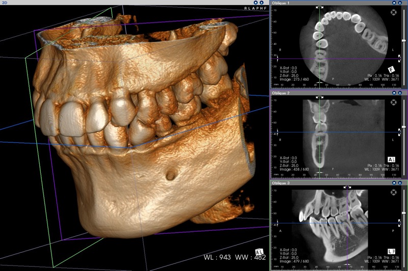 歯科用CT検査システムのお知らせ_c0198569_2151281.jpg