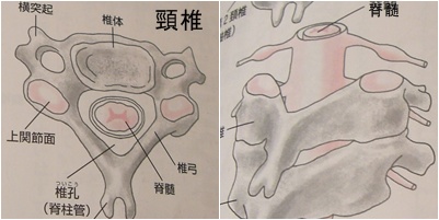 骨折と骨粗鬆症と椎間板ヘルニア_a0084343_1335989.jpg