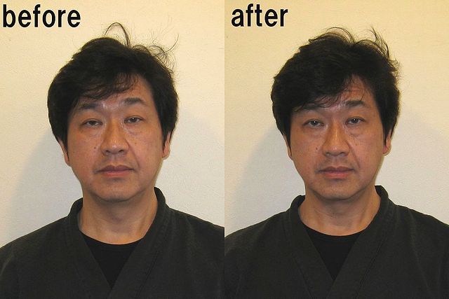 指名手配犯 いいえ違います 小顔矯正ビフォー アフターです ｉと 愛と 合氣道 心と身体と魂の調和と平安を求めて