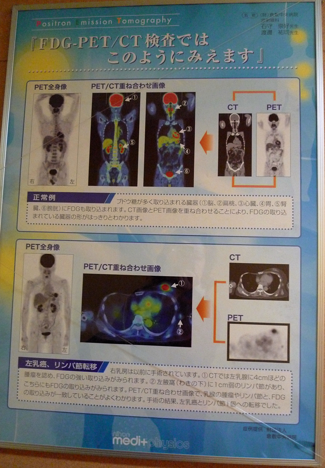 PET/CTという新しい体験の一日は終わった。_a0031363_2094181.jpg