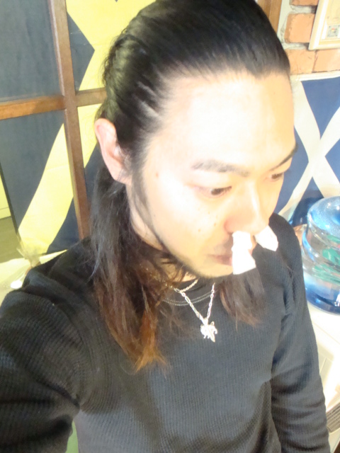 Do I have hay fever?_f0205962_15321635.jpg