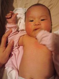 母乳飲んだら蕁麻疹 Days Of A Working Mother 母乳飲んだら蕁麻疹 Days Of A Working Mother