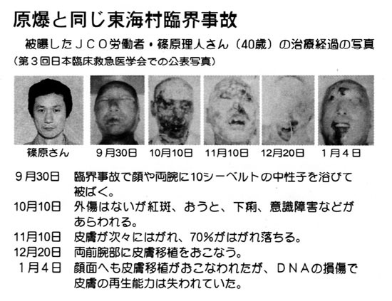 放射能被害隠す国とマスコミ 武田邦彦中部大学教授の発言 福島原発事故 1カ月で白血病の危険も_c0139575_20281874.jpg