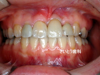 b0196070_1754377.jpg
