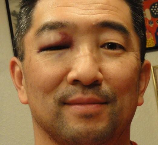 Eye shiner _c0157558_0373544.jpg