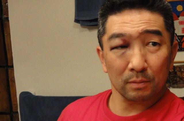 Eye shiner _c0157558_037362.jpg
