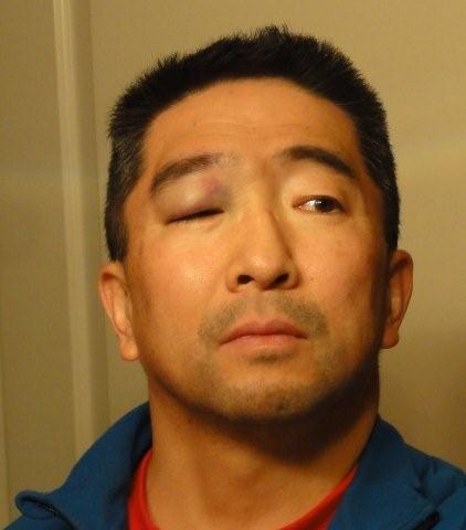 Eye shiner _c0157558_0423922.jpg