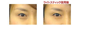 【brace】本格ホームエステ 新感覚美顔器「ライトスティック」_c0080367_9203433.jpg