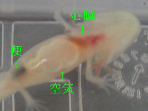 針で治療 杏雑記