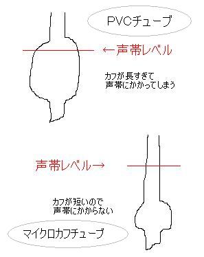 小児の気管チューブは，カフ付き？ カフ無し？_b0137188_0485099.jpg