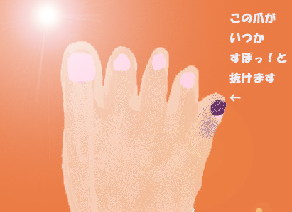 爪の話 裏nekoneko 爪の話 裏nekoneko