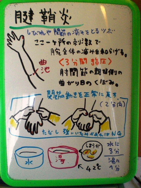 腕や手のだるさ しびれの原因 改善ストレッチ 動画付き 整体 ツボゲッチューりらく屋 朝霞 腕や手のだるさ しびれの原因 改善ストレッチ 動画付き 整体 ツボゲッチューりらく屋 朝霞