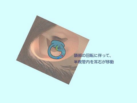 良性発作性頭位めまい症(BPPV)_e0084756_9551151.jpg
