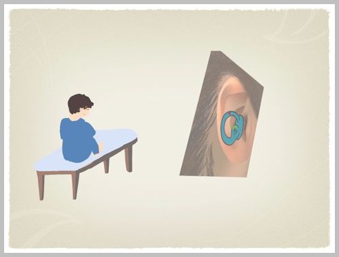 良性発作性頭位めまい症(BPPV)の理学療法_e0084756_23404024.jpg