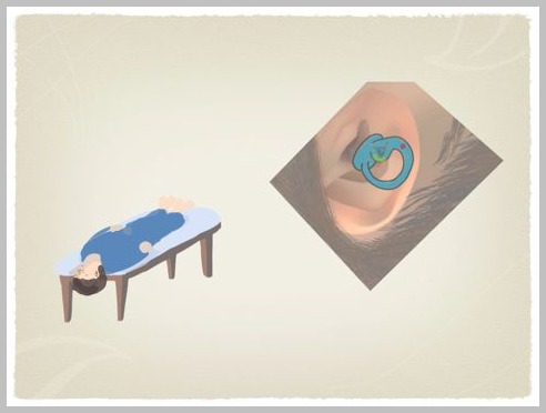 良性発作性頭位めまい症(BPPV)の理学療法_e0084756_2340513.jpg