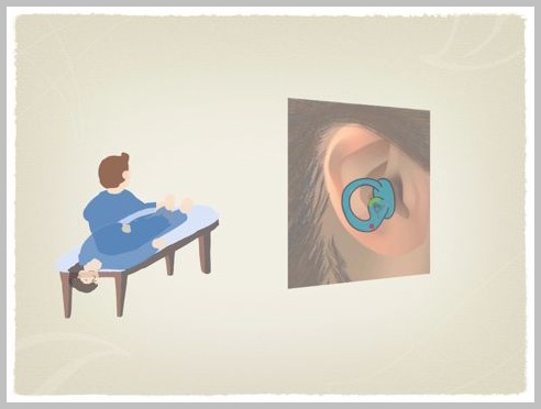 良性発作性頭位めまい症(BPPV)の理学療法_e0084756_23405671.jpg