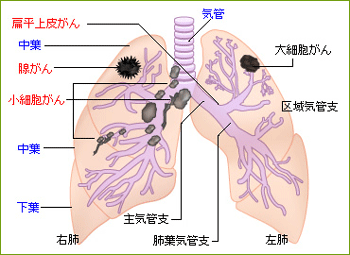 肺腺がんの予備知識_a0044453_10314779.gif