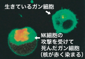 日本ウェラー・ザン・ウェル学会 シンポジウム２０１１ ～ その③_b0140293_21235860.jpg