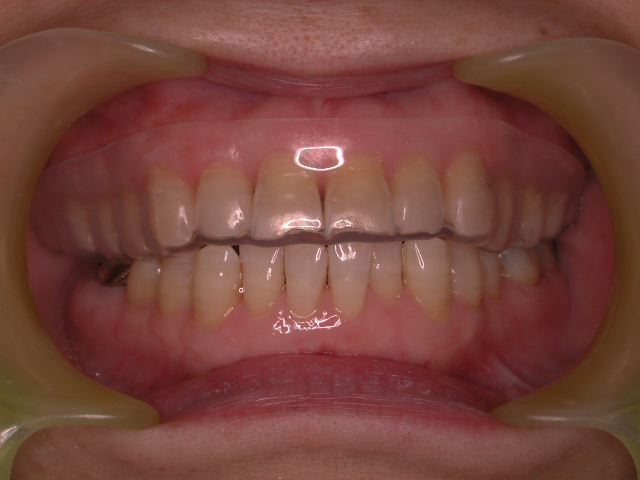 b0119466_04375.jpg