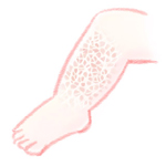 魚鱗癬という病気を知っていますか？_d0096268_19514986.jpg