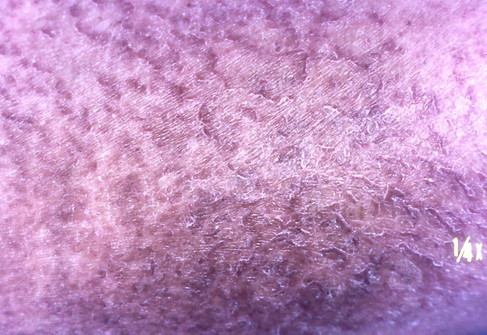 2011年11月22日教室　冬のスキンケア、とくに注意は乾燥肌：砂漠皮膚にならないために_c0219616_1945039.jpg