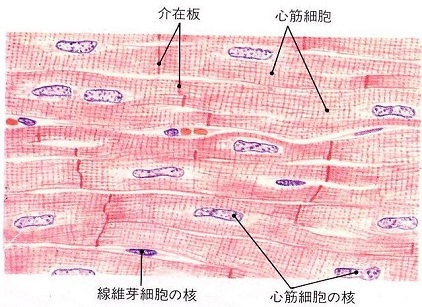 放射能と人体(6)病理組織から見る内部被曝 院長の独り言_c0139575_204736.jpg