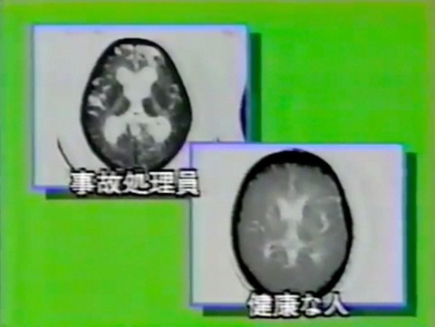 終わりなき人体汚染 「テクスト」版 2_c0139575_23141423.jpg