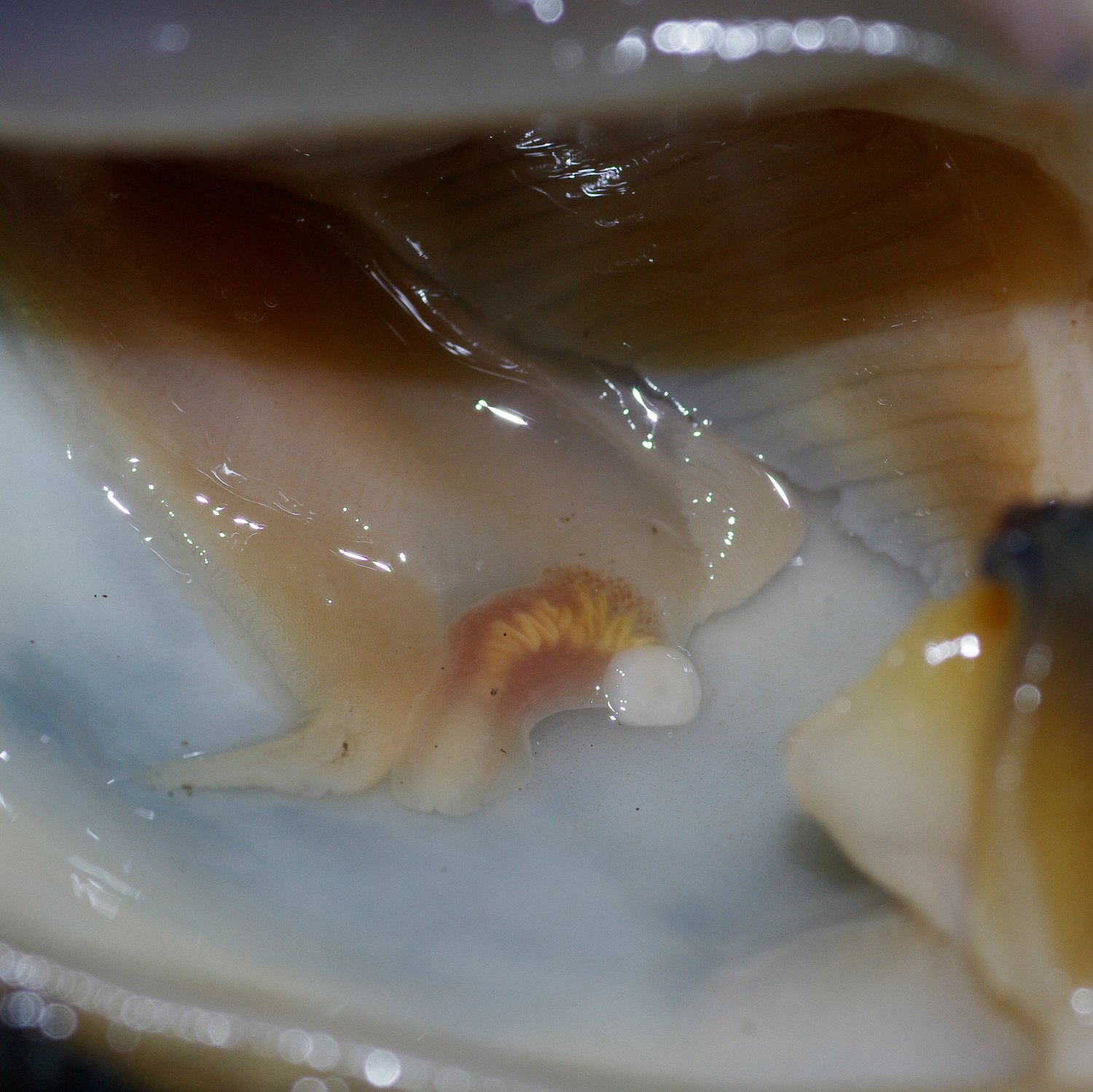 一年の締めくくりに寄生虫をw 日常から正方形に切り抜く 一年の締めくくりに寄生虫をw 日常から正方形に切り抜く
