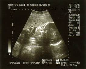 e0046665_1817710.gif