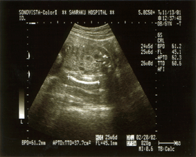e0046665_18193779.gif