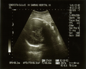 e0046665_1854548.gif