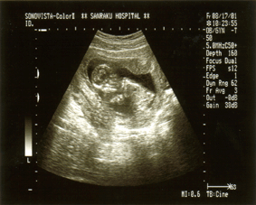 e0046665_20425263.gif