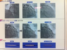 サイレントキラーの怖さを実感して候！_c0189188_9573248.jpg