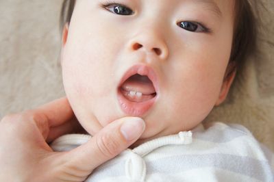生後9ヶ月 前歯が黄色い ノア Plus