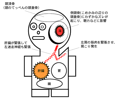 耳が痛い 〜ある日の施術より〜_e0073240_7544430.gif