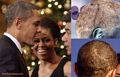 頭の傷跡：オバマ、ケイト、ウィリアム_c0139575_11391931.jpg