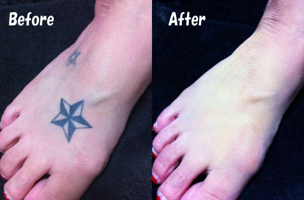 Tattooカバー Tattoo隠し 刺青隠し 愛知県一宮市のtattoo Studio Million Dollar Tattoo Tattooカバー 刺青隠し Tattooカバー Tattoo隠し 刺青隠し 愛知県一宮市のtattoo Studio Million Dollar Tattoo Tattooカバー 刺青隠し