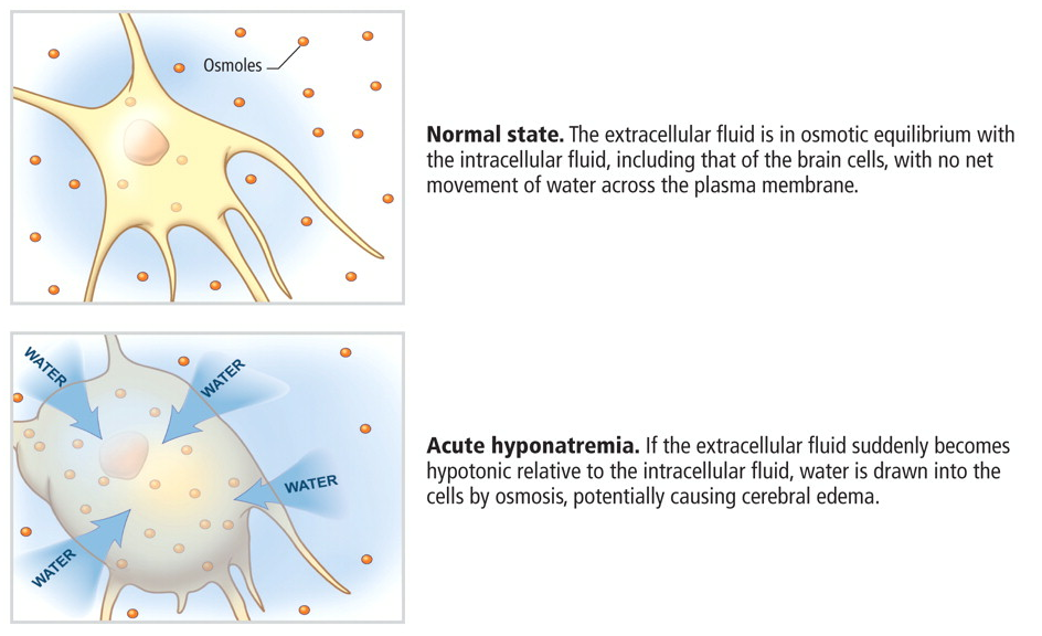 Hypohydration vs Hyperhydration。防ぐべきはどっち？_b0112009_12475090.png